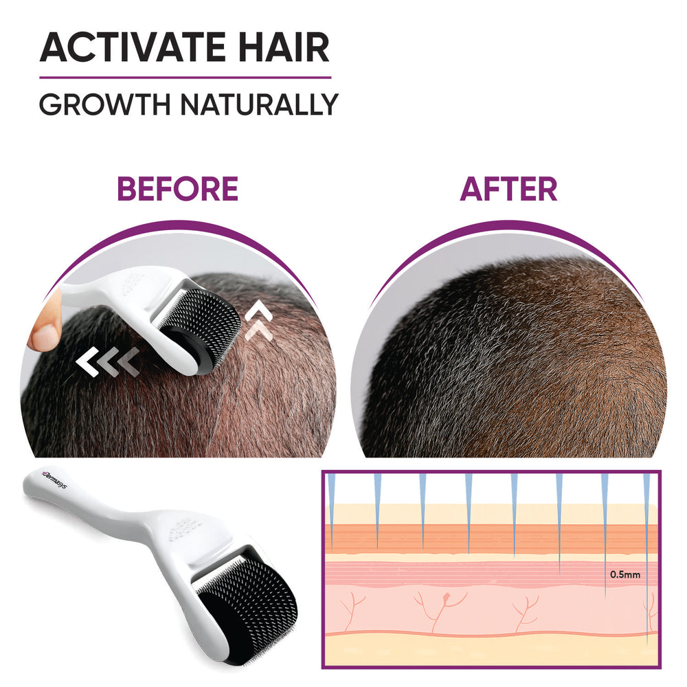 Derma roller 0.5mm for beard growth and patchy beard improvement